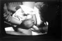 hRPbirth